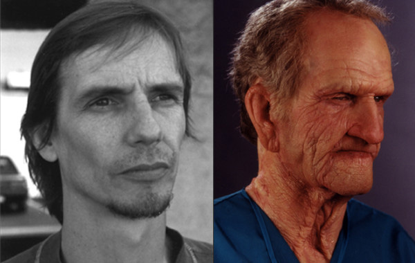 Prosthetic Aging